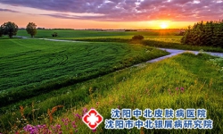 顽固牛皮癣为什么冬重夏轻