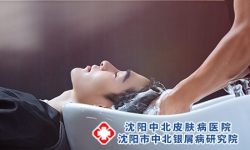 得了牛皮癣头发做护理行吗？