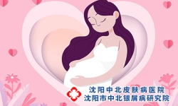 女性孕期如何防治牛皮癣