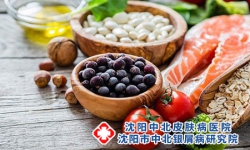 银屑病的传播途径及预防方法详解