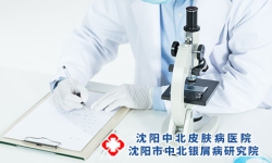 患上牛皮癣怎么办比较好