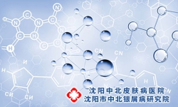怎样减少沈阳牛皮癣的复发几率