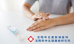 重视牛皮癣的预防工作？