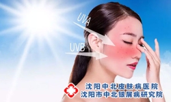 银屑病脸上起皮的原因?
