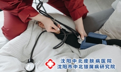 银屑病“钟爱”这些身体部位，您“中招”了吗?