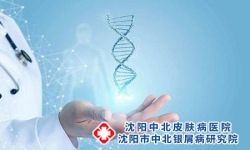 遗传性牛皮癣如何提前预防？