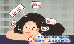 女性怎样选择银屑病医院