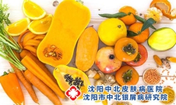 红皮型牛皮癣患者在夏天能喝啤酒吗?