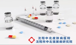 全身牛皮癣该怎样治疗呢？