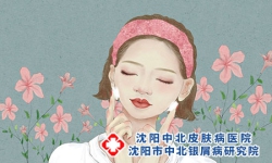 女性脸部牛皮癣患者使用的护肤品合集