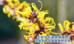 金银花对银屑病有康复作用吗?