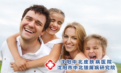 预防银屑病，专家整理了六种方法!