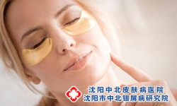 　银屑病的极简护肤之道，一起看过来!