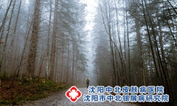 银屑病患者看过来!这些禁忌你中招了吗?沈阳银屑病医院，沈阳牛皮癣医院，沈阳皮肤病医院