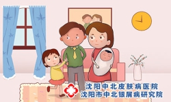 小孩牛皮癣症状有哪些？