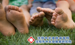儿童患上了银屑病后会有什么特征?
