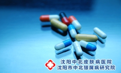 牛皮癣药物治疗有什么好处？