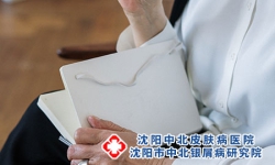 沈阳皮肤病专科医院：如何正确认识和治疗银屑病