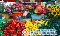 寻常型银屑病能吃什么东西好?