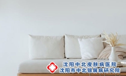 牛皮癣给患者的影响有什么?