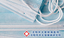沈阳有哪些医院治银屑病为什么会得牛皮癣疾病呢
