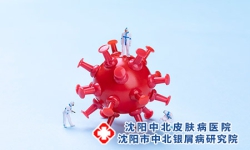 沈阳牛皮癣病发的内外因