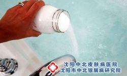 洗澡对沈阳牛皮癣患者的益处