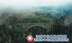 长期处于这种环境，银屑病不复发都难!