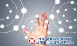 银屑病“频繁复发或加重”，到底哪里出了错!