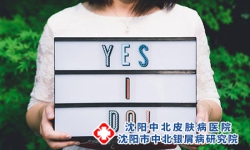 牛皮癣常见治疗误区 牛皮癣的注意事项有哪些呢