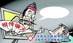 沈阳银屑病治疗医院：年轻女性朋友患上牛皮癣蕞好偏方