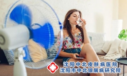 银屑病斑块状是比较严重的吗?