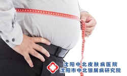瘦跟肥胖哪个更容易患银屑病？