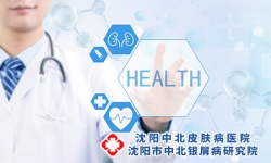 寻常型牛皮癣怎么治-寻常型牛皮癣的3个疗法分享