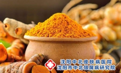 本人有牛皮癣可否吃三七粉？