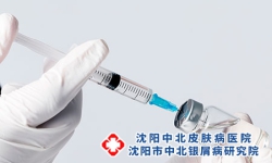 沈阳治疗银屑病的司库奇尤单抗治疗什么