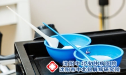 牛皮癣病人为什么不能烫头发?