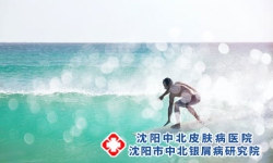 沈阳中北银屑病研究院：引起银屑病的诱因有哪些?要注意这几个方面