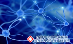 神经性牛皮癣怎么引起的?