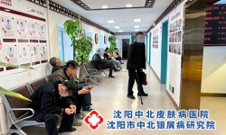 沈阳皮肤病治疗好医院 本地皮肤问题就诊实用指南
