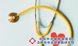 沈阳银屑病治疗：心理治疗在银屑病晚期治疗中的作用是什么