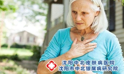 年龄大了牛皮癣还能治愈么