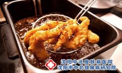 患牛皮癣忌口的食物有什么?