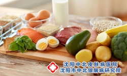 牛皮癣饮食方面注意事项有哪些？