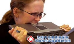 患了牛皮癣怎么办才好呢？