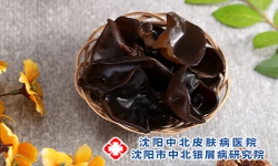 牛皮癣可以吃木耳吗-患者吃木耳可以养血润肤？