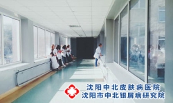 沈阳看牛皮癣的医院哪个好?