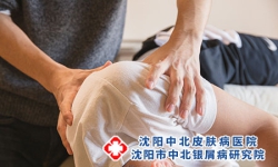 银屑病危害很大生活护理应该怎么做?
