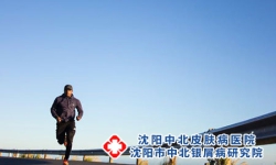 沈阳中北银屑病：银屑病患者在运动期间，要注意哪些锻炼原则?