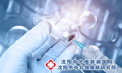银屑病用药有哪些原则